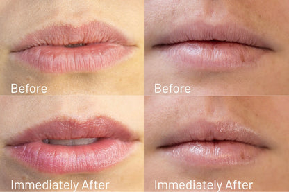 Four-panel before and after close-up of lips showing hydration results from Butterface Tallow Lip Balm, comparing dry lips before application to smoother, moisturized lips immediately after.